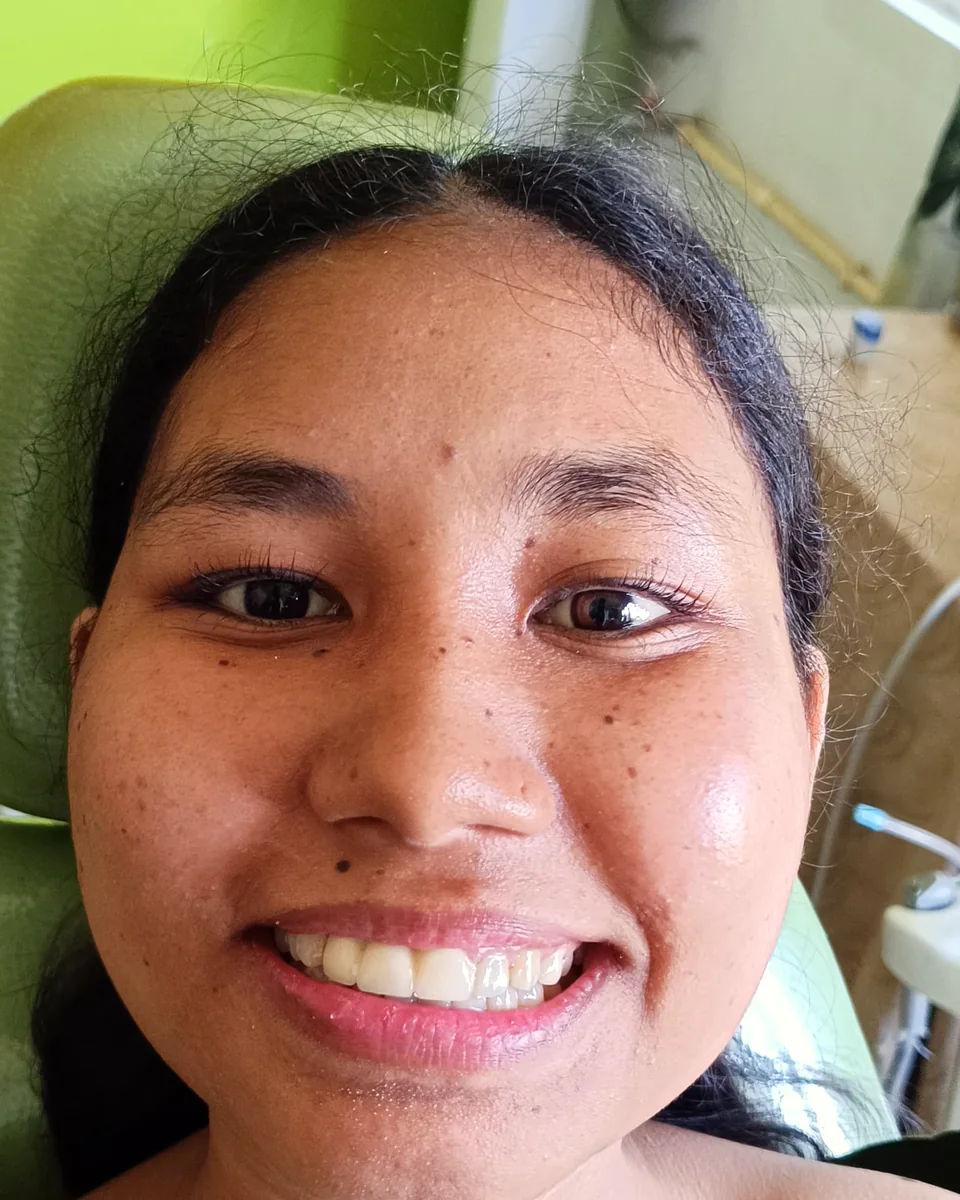 After: Restored to match her smile